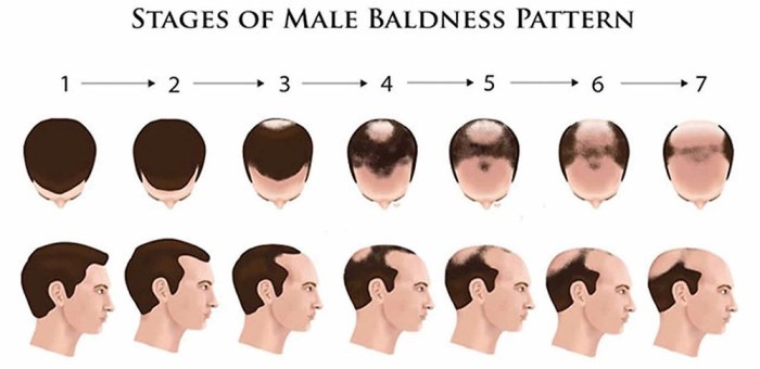 hair carehair losscauses of hair loss men