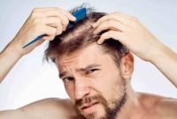 what causes hair loss in men