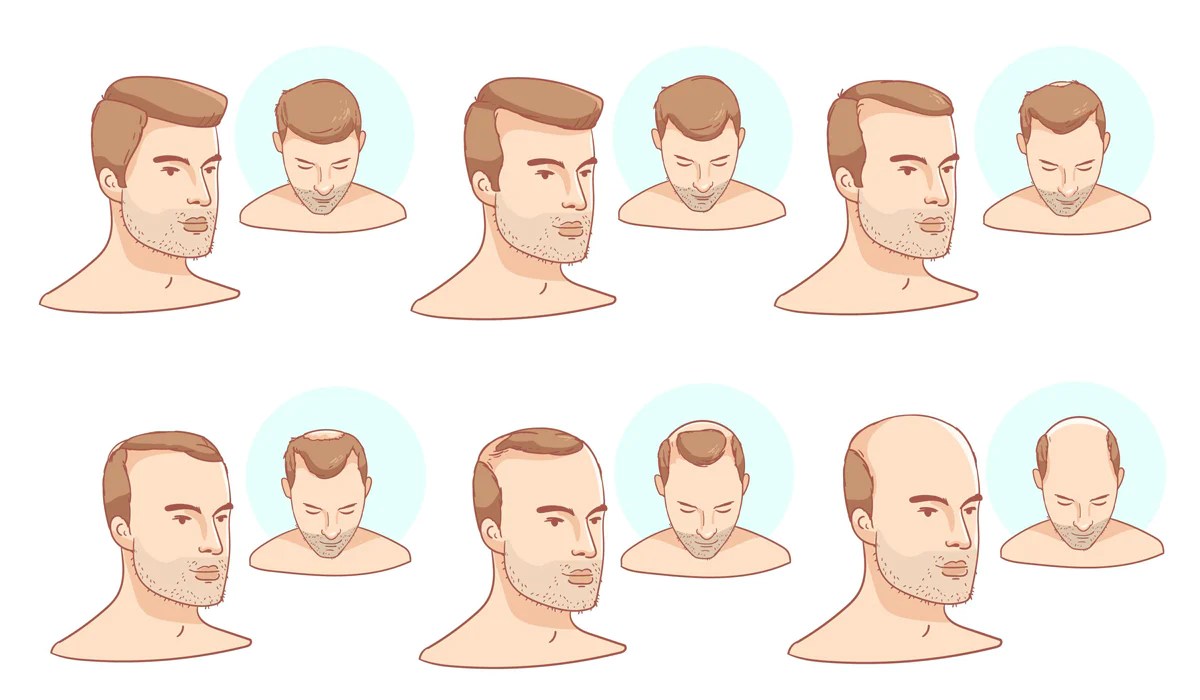 men hair causes loss signs