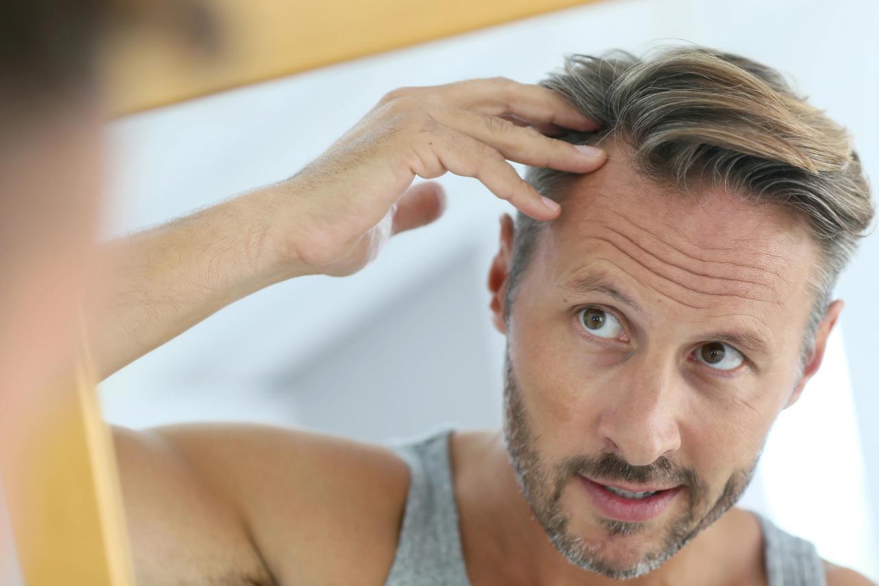 hair carehair losscauses of hair loss men