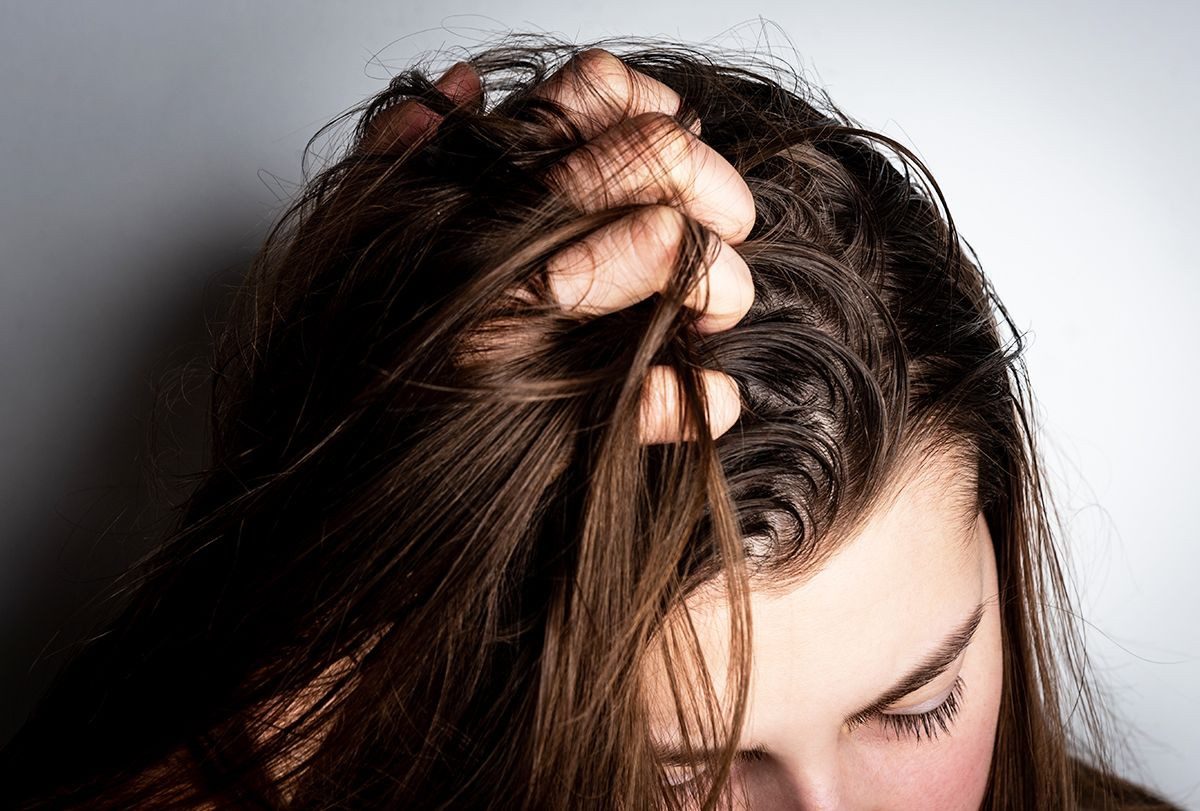 Rambut Berminyak Berlebihan Penyebabnya Apa