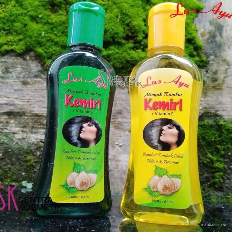 Photo via Bing Images - Manfaat Minyak Kemiri Bakar untuk Mengatasi Rambut Botak Depan
