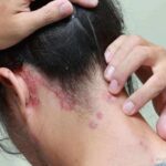 Photo via Bing Images - Penyebab Kulit Kepala Gatal dan Berkerak Meski Rutin Keramas