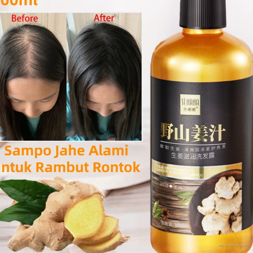 Photo by shopee.co.id - 10 Rekomendasi Shampo Biotin Terbaik untuk Atasi Rambut Rontok