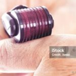 Photo by istockphoto.com - Berapa Kali Seminggu Jadwal Terbaik Pakai Dermaroller untuk Stimulasi Folikel