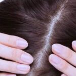 Photo by timesindonesia.co.id - Cara Menghilangkan Ketombe Tebal yang Menghambat Penyerapan Serum Rambut