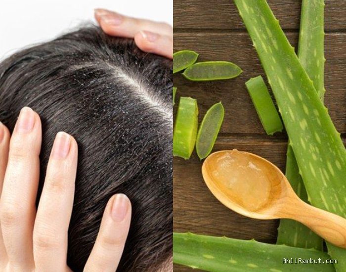 Photo by mediaedukasi.id - Manfaat Lidah Buaya untuk Mengatasi Rambut Kering dan Kusam