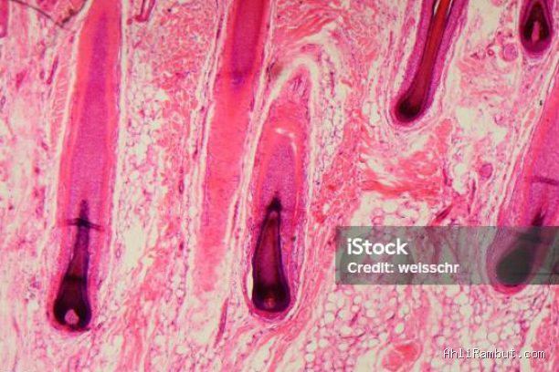 Photo by istockphoto.com - Tanda Folikel Rambut Masih Hidup dan Masih Bisa Ditumbuhkan Kembali
