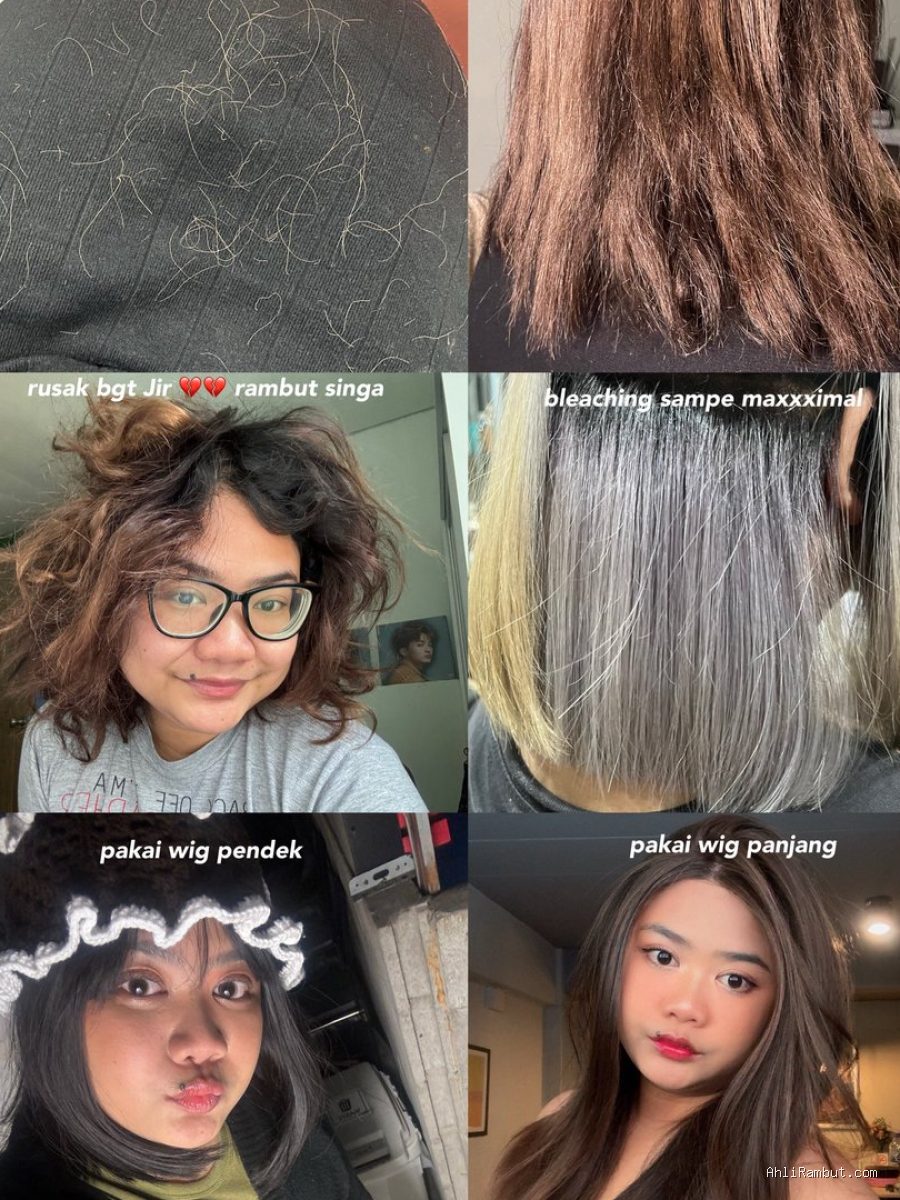 Tanda Kerontokan Rambut Akibat Hormon DHT Bukan Sekadar Rontok Biasa