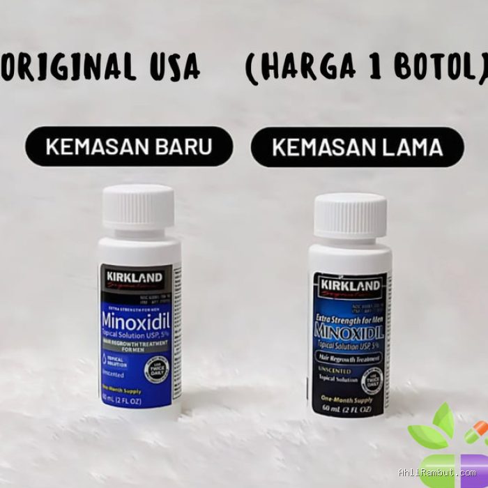 Bolehkah Menggunakan Minoxidil 5 Persen untuk Wanita yang Mengalami Penipisan