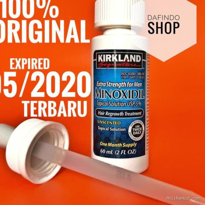 Efek Samping Bulu Halus Tumbuh di Dahi dan Pelipis Akibat Minoxidil Meleber