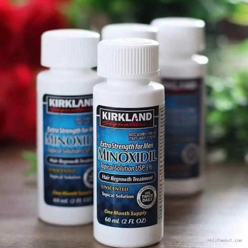 Penyebab Minoxidil Tidak Bekerja Menumbuhkan Rambut di Titik Tertentu