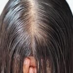Photo by cantika.com - Penyebab Rambut Menipis Hanya di Bagian Pusaran Udel-Udel Kepala Belakang