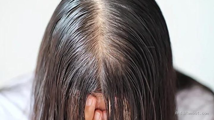 Photo by cantika.com - Penyebab Rambut Menipis Hanya di Bagian Pusaran Udel-Udel Kepala Belakang