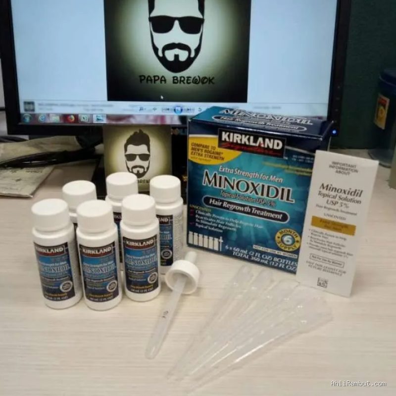 Trik Mencegah Tetesan Minoxidil Mengalir ke Dahi Saat Diaplikasikan